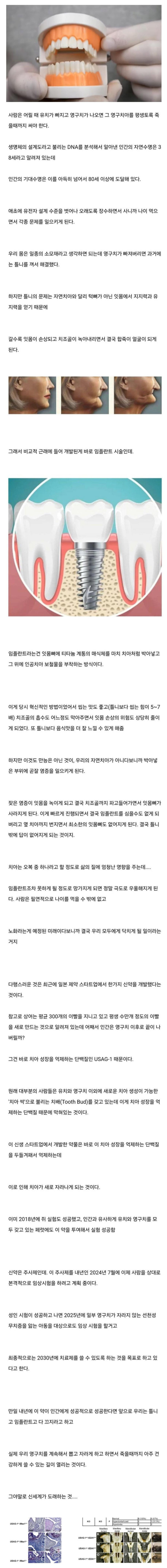 백원짜리 개그 특이점이 오고 있다는 영구치아.jpg