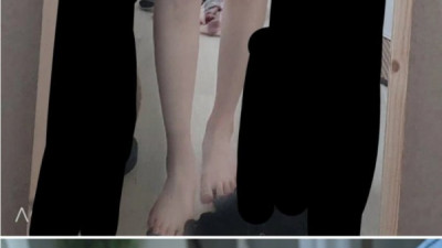 어익후  뽀얀 살결