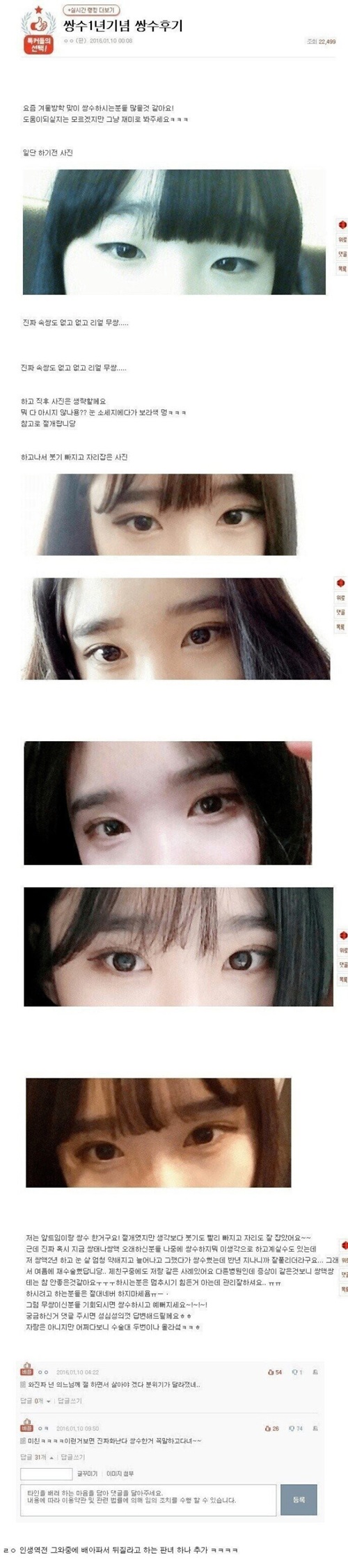 쌍수 1년 후기
