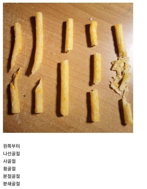 과자로 알아보는 뼈 골절종류